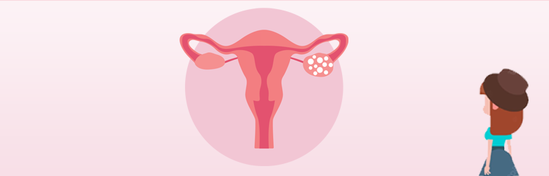 Ovarian Cysts & Polycystic Ovarian Syndrome (PCOS)